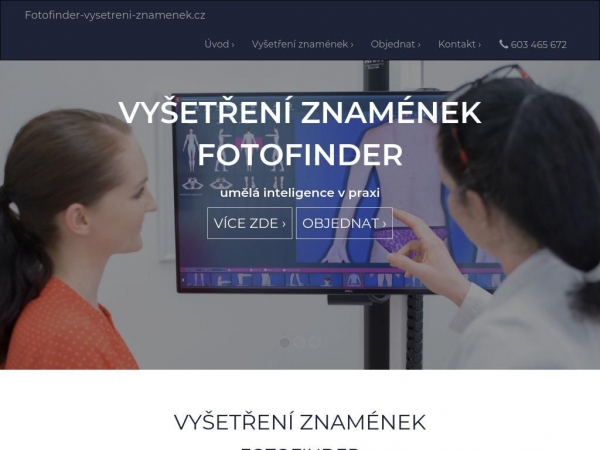 fotofinder-vysetreni-znamenek.cz